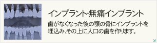 インプラント・無痛インプラント